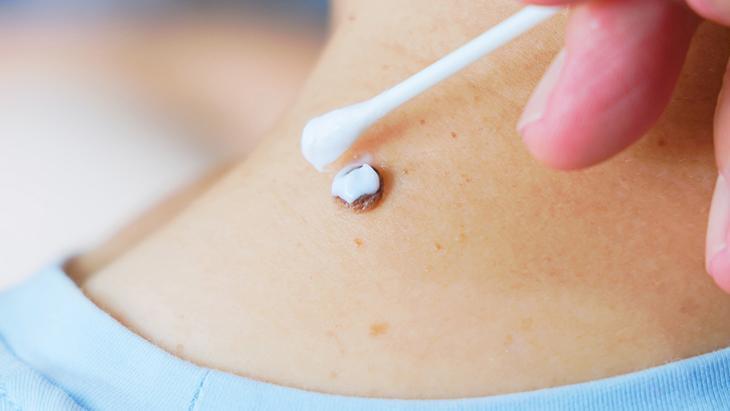 lazer de yaptiran da var solusyon suren de her ben masum degil incelenmeli pUwOyzO8.jpg